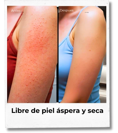 L áspera