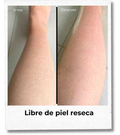L reseca